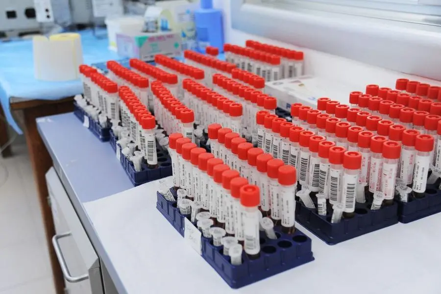 LABORATORIO LABORATORI TEST TAMPONE TAMPONI COVID 19 PROVETTE PROVETTA