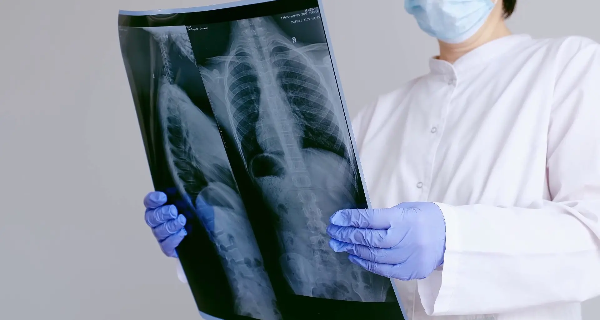 Tumori rari, i sarcomi richiedono diagnosi tempestive e alta specializzazione