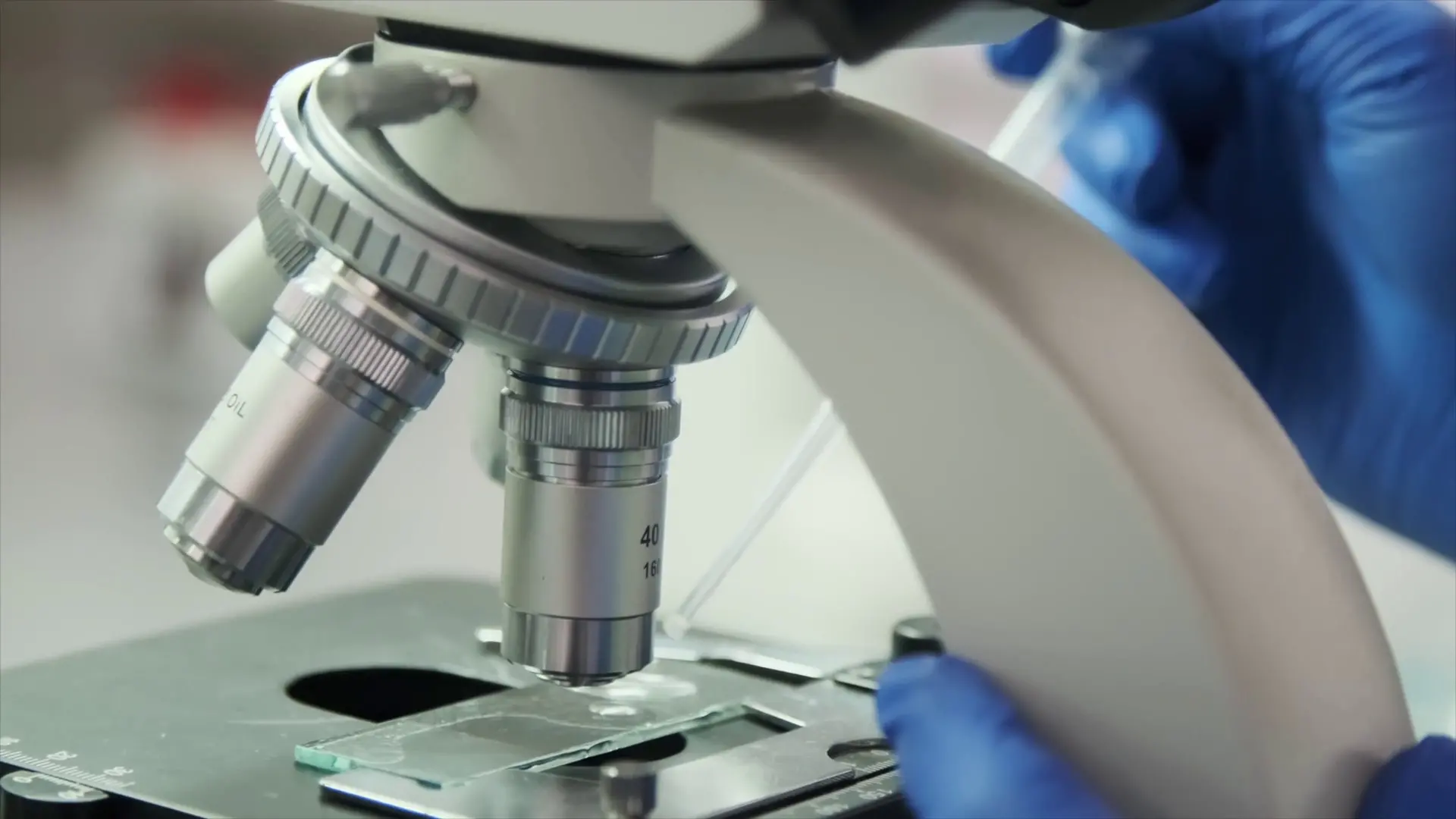 HIV, nuove conferme su terapie e profilassi long-acting