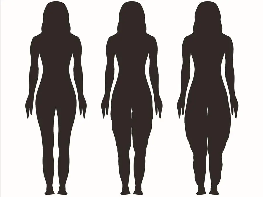 Lipedema, un abnorme accumulo di grasso sottocutaneo