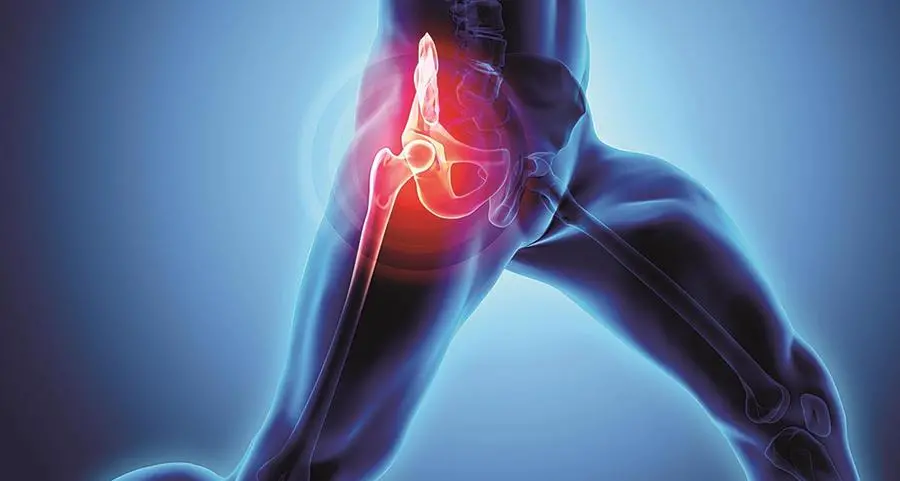 Artrosi dell’anca, come riconoscere i sintomi