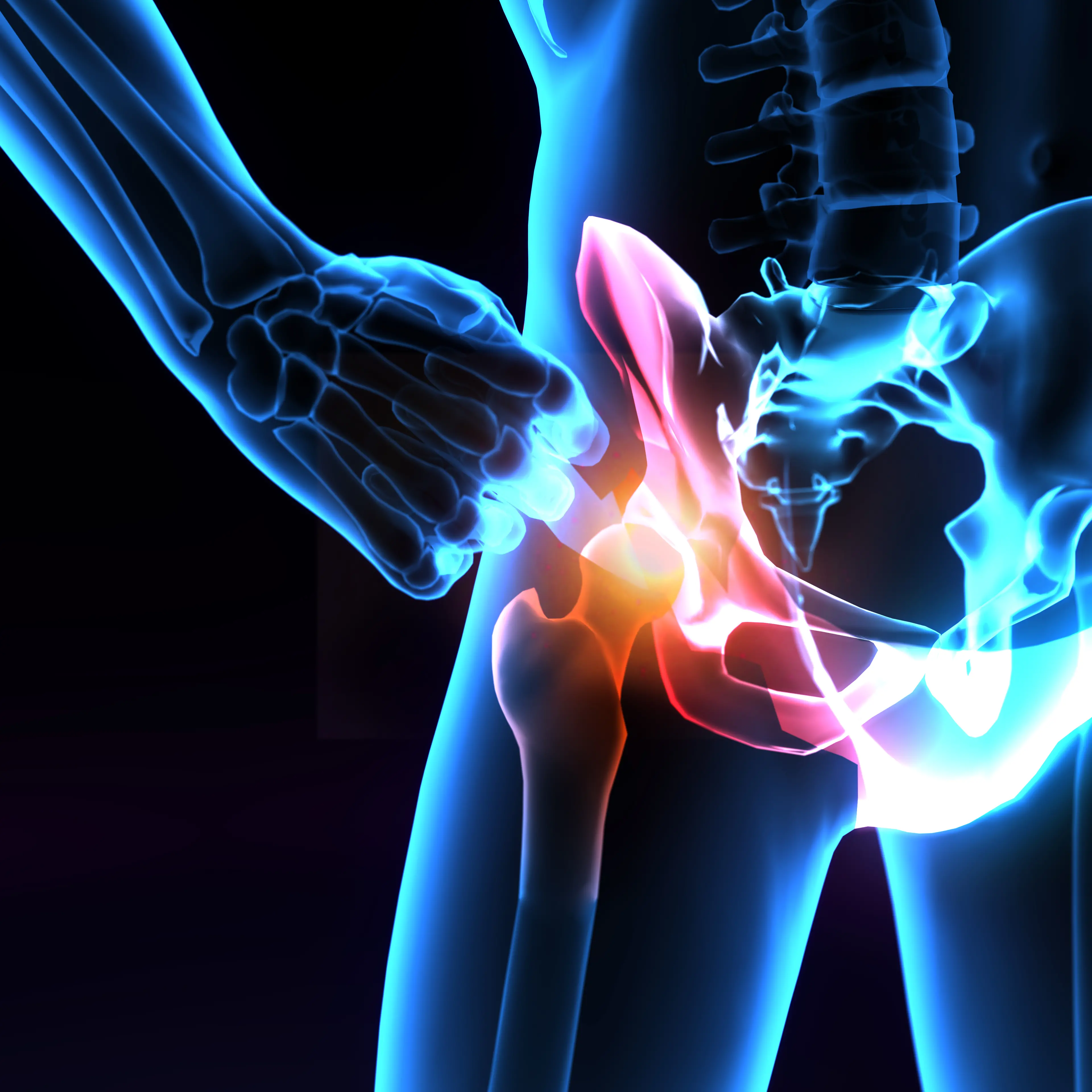 Le cause della degenerazione dell’anca