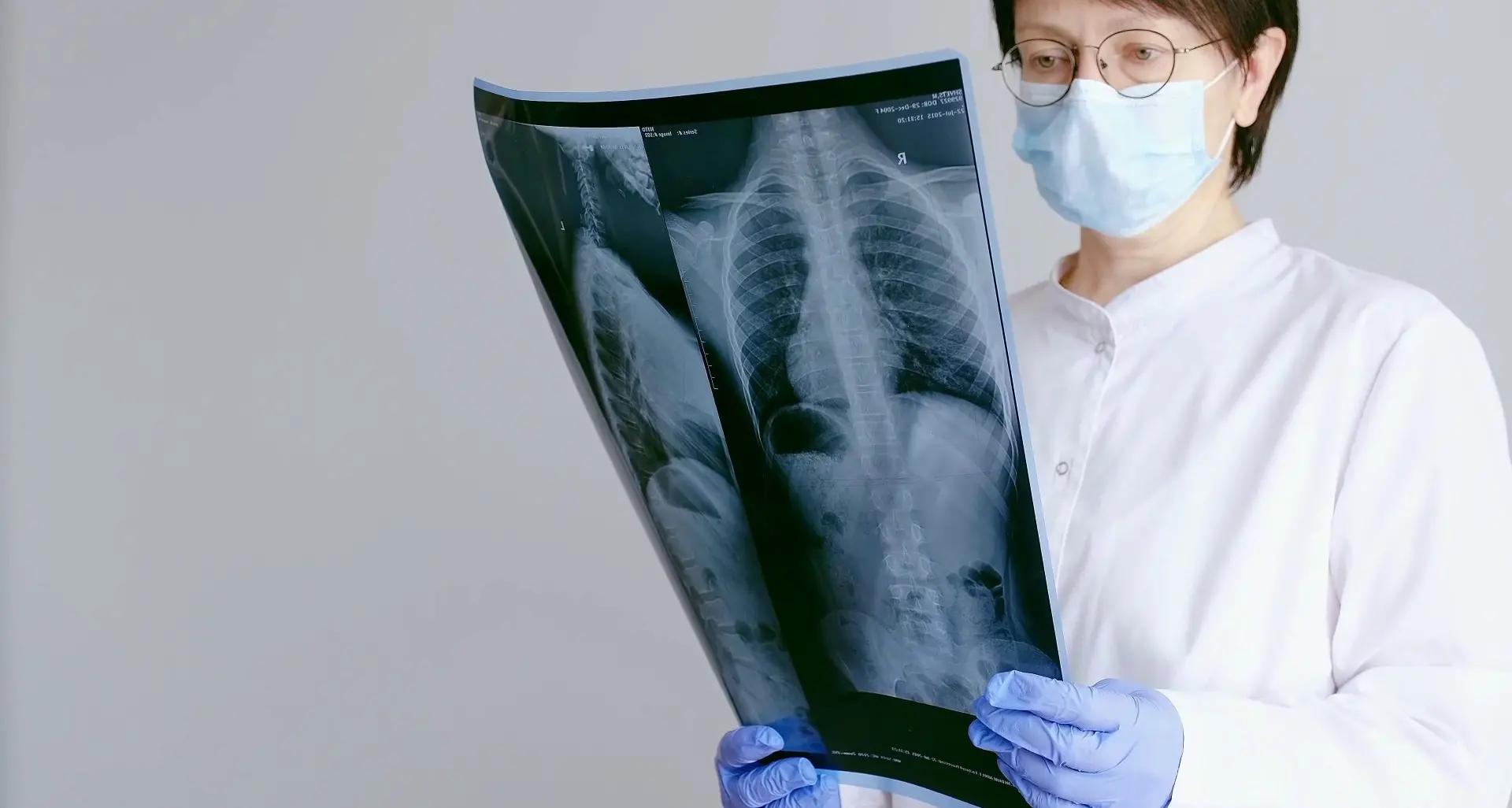 Il Covid ha cambiato percezione malattie respiratorie, nuova attenzione a rischi