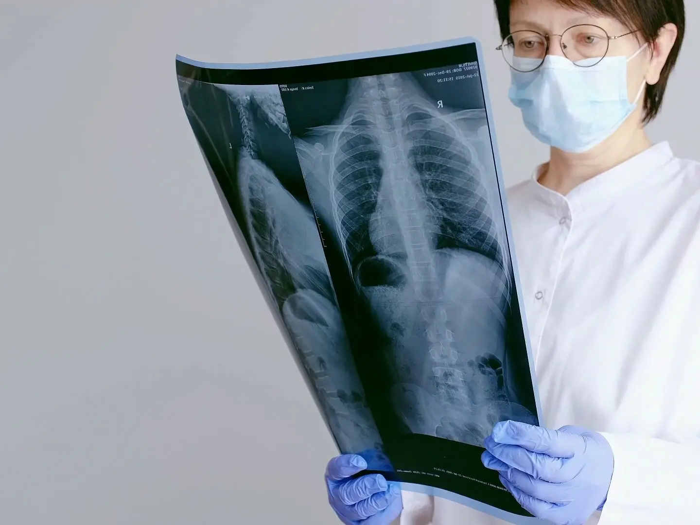 Il Covid ha cambiato percezione malattie respiratorie, nuova attenzione a rischi