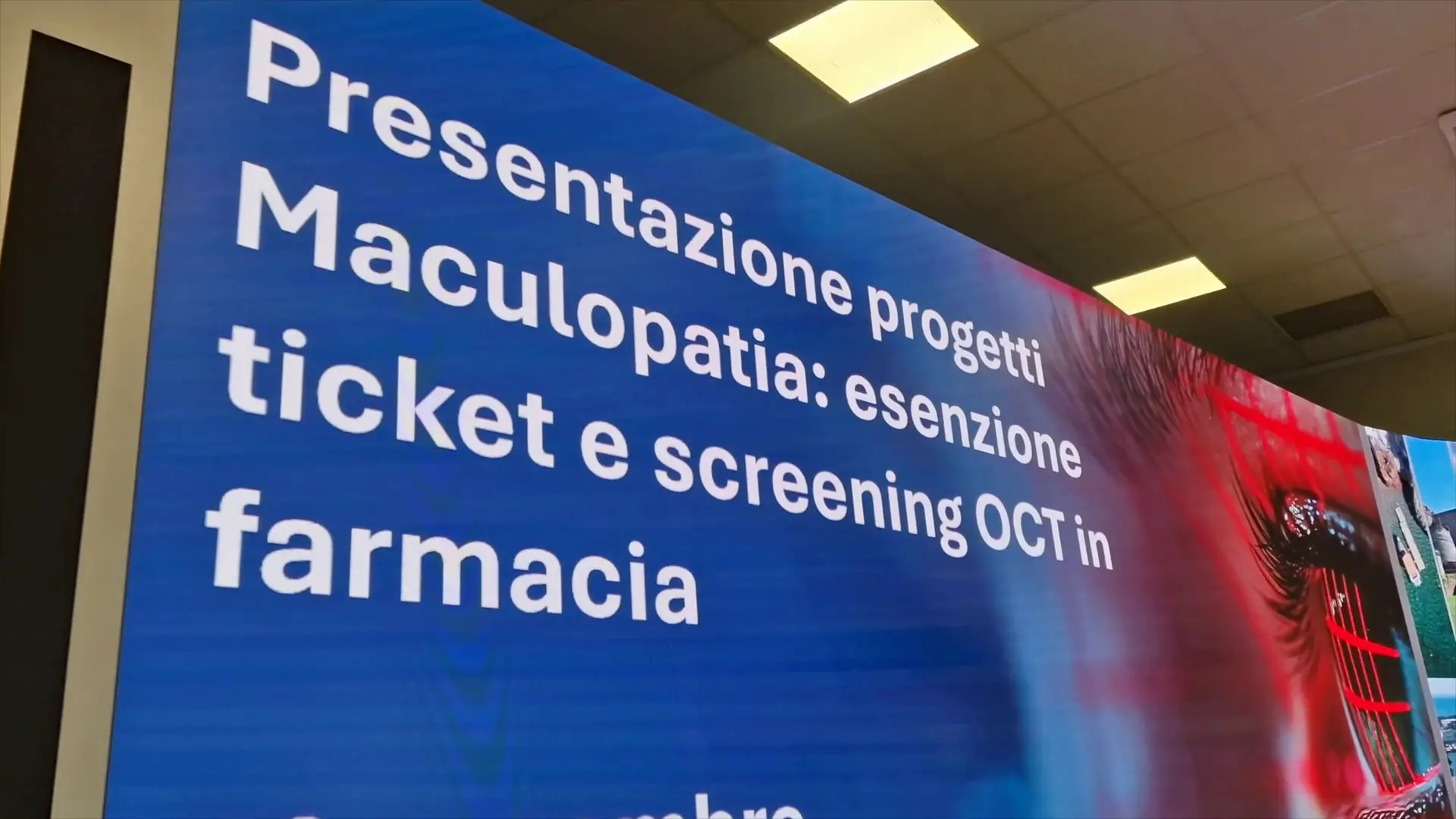 Maculopatia essudativa, da gennaio 2026 in Liguria l'esenzione dal ticket
