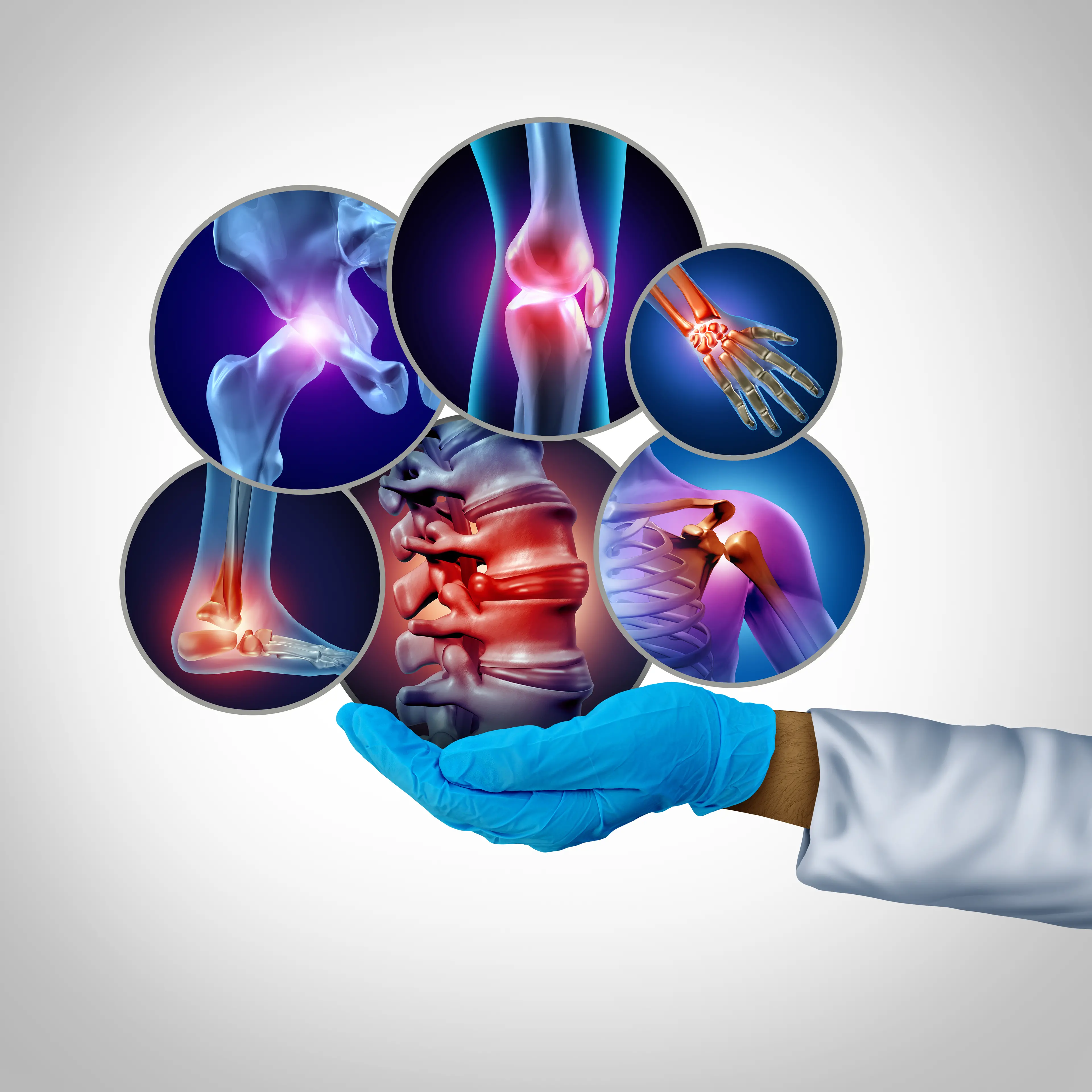 Malattie reumatologiche: ve ne sono oltre 200 tipi