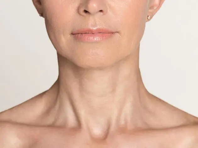 Il lifting cervicale per ringiovanire il collo