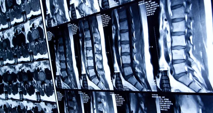Cisti sinoviali: cause, sintomi, diagnosi e cure