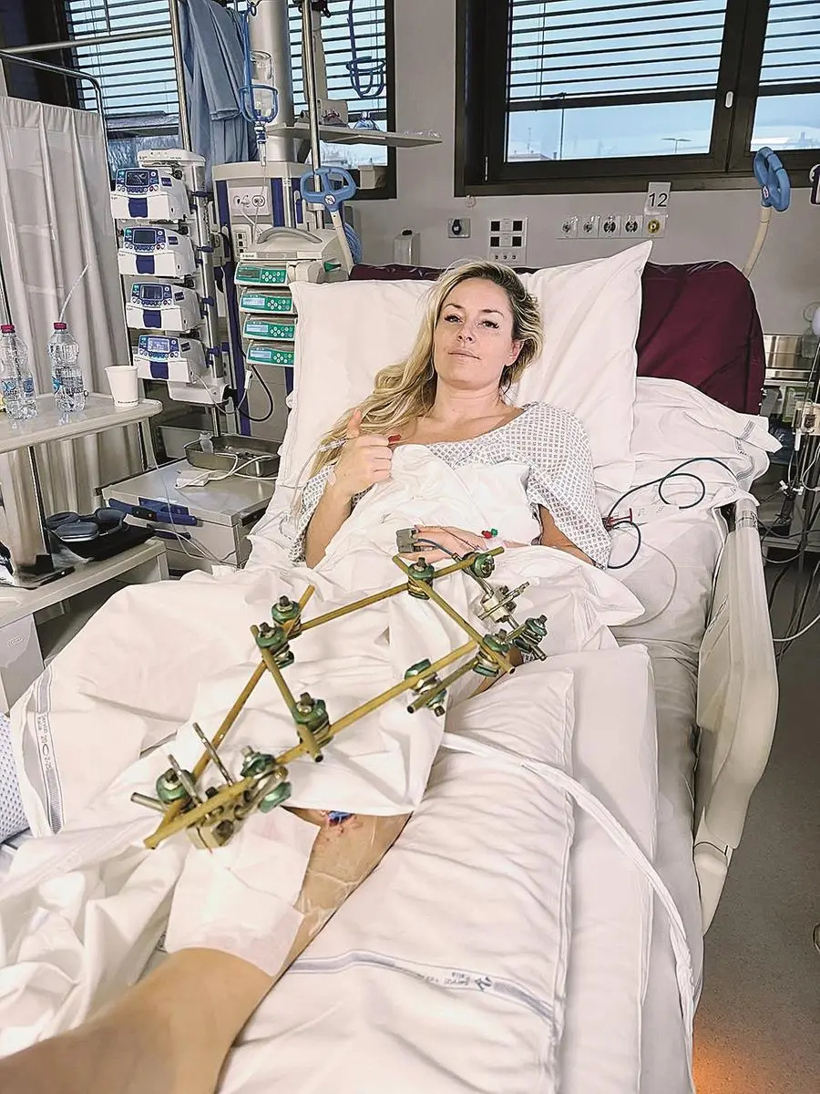 La sciatrice Usa Lindsey Vonn fa segno che tutto è ok dal letto dell'ospedale, dove ha subito un intervento per la frattura complessa della tibia in seguito alla rovinosa caduta nella discesa libera alle ultime Olimpiadi invernali.