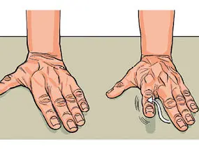 Cinque esercizi per le mani con artrosi