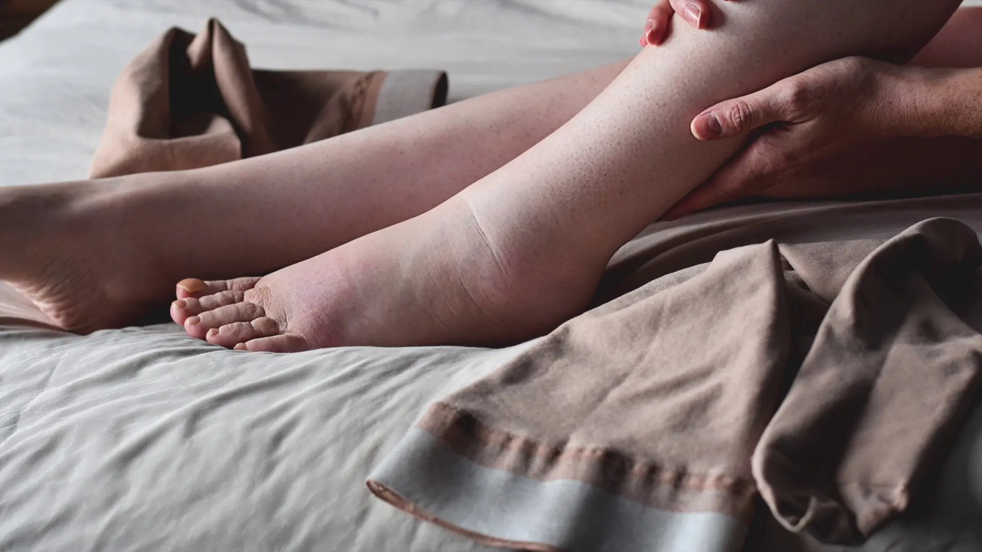 Sanità, il 6 marzo si celebra la Giornata Mondiale del Linfedema