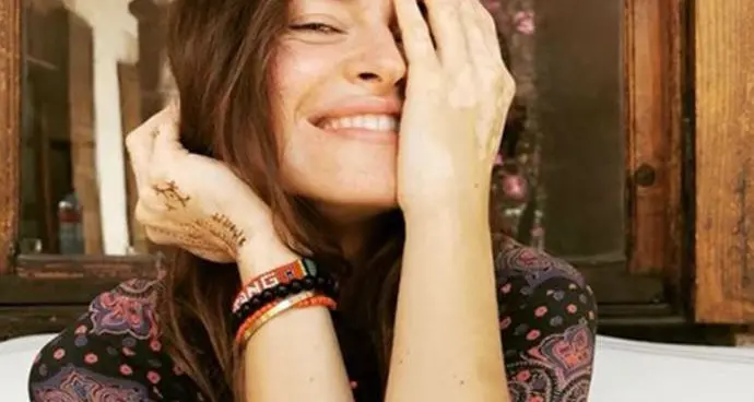 Kasia Smutniak e Mara Maionchi: «La nostra vitiligine non è più un dramma»
